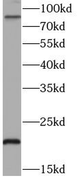TNFAIP3 Rabbit Polyclonal Antibody