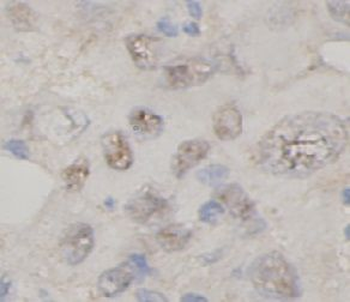 TNFAIP3 Rabbit Polyclonal Antibody