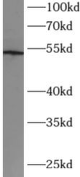 CX3CR1 Rabbit Polyclonal Antibody