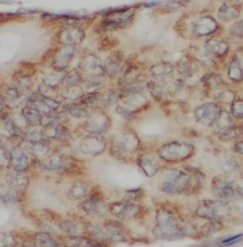CX3CR1 Rabbit Polyclonal Antibody