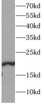 SKP1 Rabbit Polyclonal Antibody