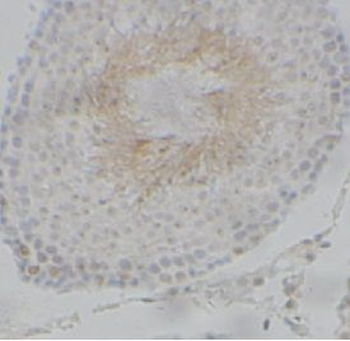 SKP1 Rabbit Polyclonal Antibody