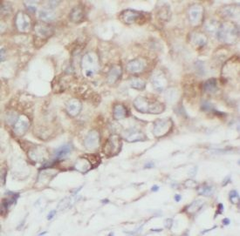 AURKA Rabbit Polyclonal Antibody