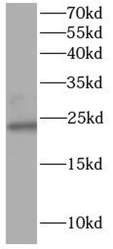 NPC2 Rabbit Polyclonal Antibody