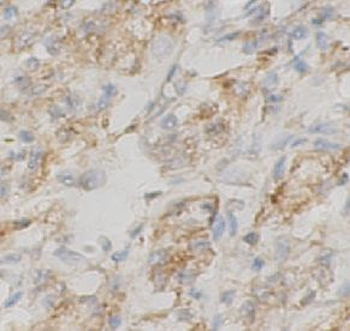 NPC2 Rabbit Polyclonal Antibody