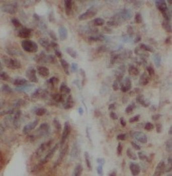 MED1 Rabbit Polyclonal Antibody