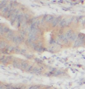 TRAF1 Rabbit Polyclonal Antibody