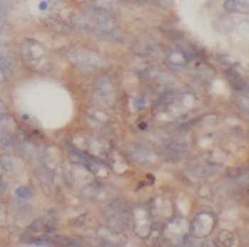 CYP27A1 Rabbit Polyclonal Antibody