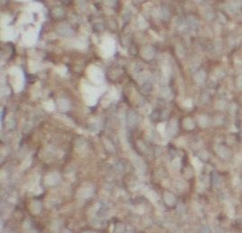 MAP2K4 Rabbit Polyclonal Antibody