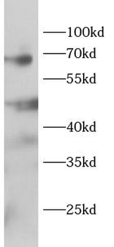 TRAF5 Rabbit Polyclonal Antibody
