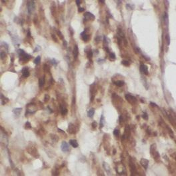 TRAF5 Rabbit Polyclonal Antibody