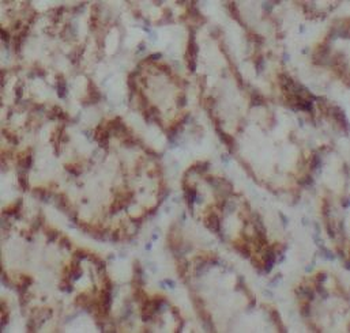 P2RX4 Rabbit Polyclonal Antibody
