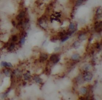 P2RX7 Rabbit Polyclonal Antibody