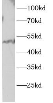 PRKN Rabbit Polyclonal Antibody