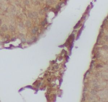 PRKN Rabbit Polyclonal Antibody