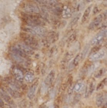 GLI3 Specific Rabbit Polyclonal Antibody
