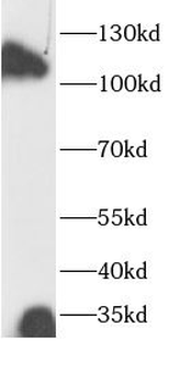 IL4R Rabbit Polyclonal Antibody
