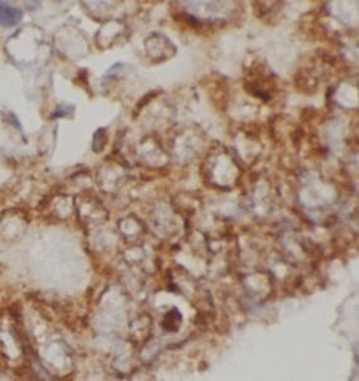 IL4R Rabbit Polyclonal Antibody