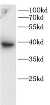 MOK Rabbit Polyclonal Antibody