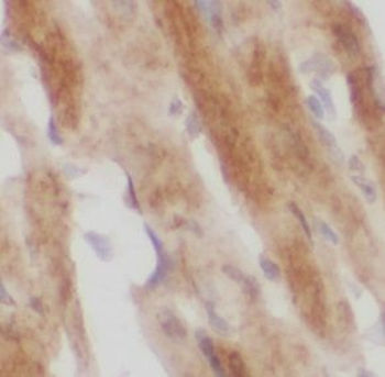 MOK Rabbit Polyclonal Antibody