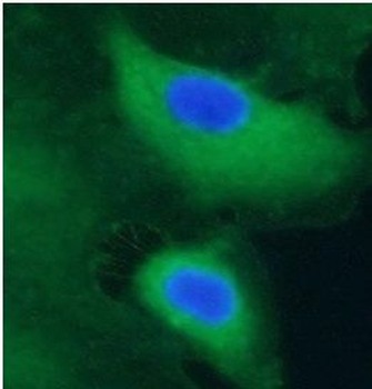 CBLIF Rabbit Polyclonal Antibody