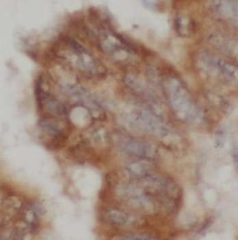 CBLIF Rabbit Polyclonal Antibody