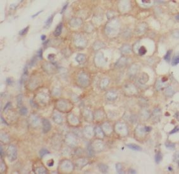 CDH1 Mouse Monoclonal Antibody