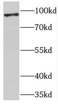 USP5 Rabbit Polyclonal Antibody