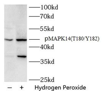 Phospho MAPK14 (T180/Y182) Rabbit Polyclonal Antibody