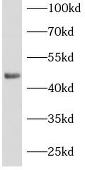 MSI1 Rabbit Polyclonal Antibody