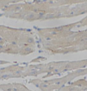 SNCG Rabbit Polyclonal Antibody