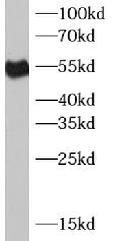 FCGR3A Rabbit Polyclonal Antibody