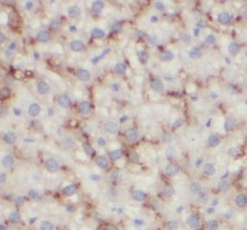 FCGR3A Rabbit Polyclonal Antibody