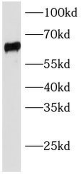 SLC22A6 Rabbit Polyclonal Antibody