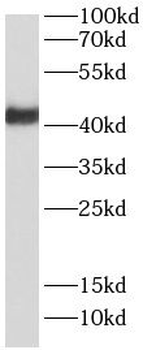 RNF34 Rabbit Polyclonal Antibody