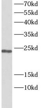 PTTG1 Rabbit Polyclonal Antibody