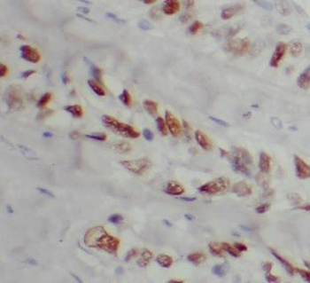 PTTG1 Rabbit Polyclonal Antibody