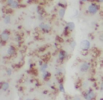 IL5 Rabbit Polyclonal Antibody