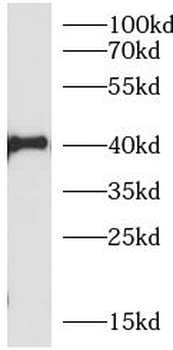 TNFAIP3 Rabbit Polyclonal Antibody