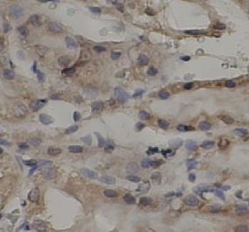 TNFAIP3 Rabbit Polyclonal Antibody