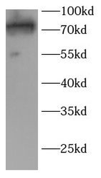 TAB2 Rabbit Polyclonal Antibody
