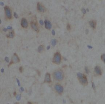 TAB2 Rabbit Polyclonal Antibody
