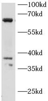 IRAK3 Rabbit Polyclonal Antibody