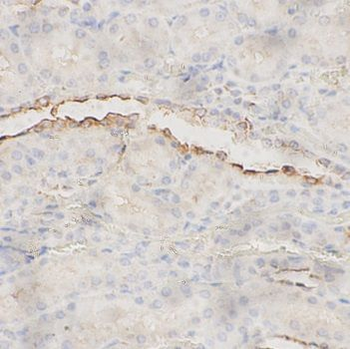 SLC4A1 Rabbit Polyclonal Antibody