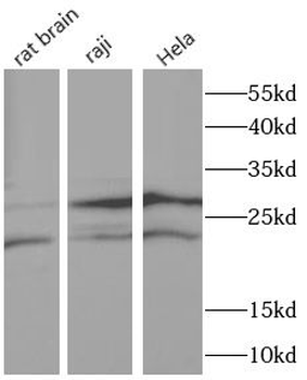 AICDA Rabbit Polyclonal Antibody