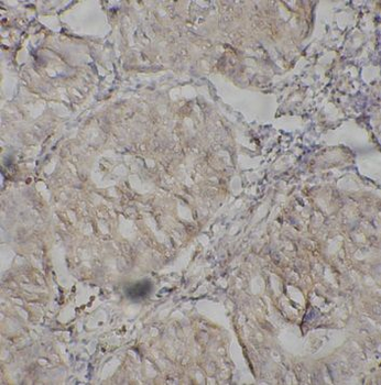 AICDA Rabbit Polyclonal Antibody