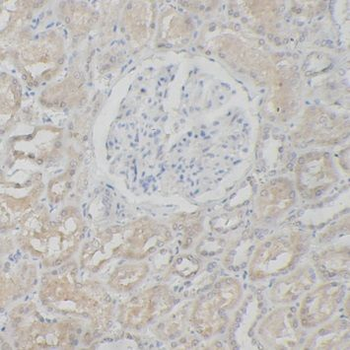 SMARCB1 Rabbit Polyclonal Antibody
