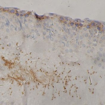 CST3 Rabbit Polyclonal Antibody