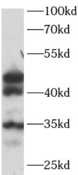 SHBG Rabbit Polyclonal Antibody