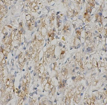 SHBG Rabbit Polyclonal Antibody